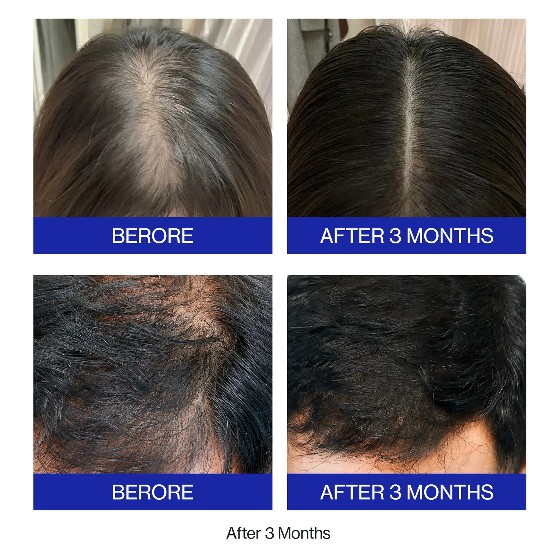 EHDOC Anti-Hair Loss and Hair Strengthening Serum